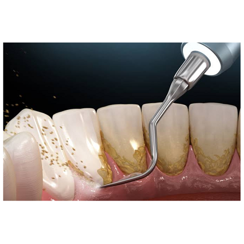 ORAL HYGIENE