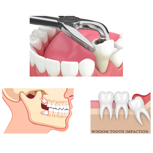 ORAL SURGERY