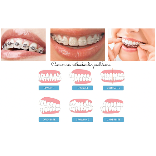 ORTHODONTICS