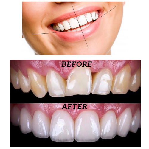 SMILE DESIGNING